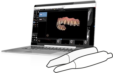IO Scanner Link